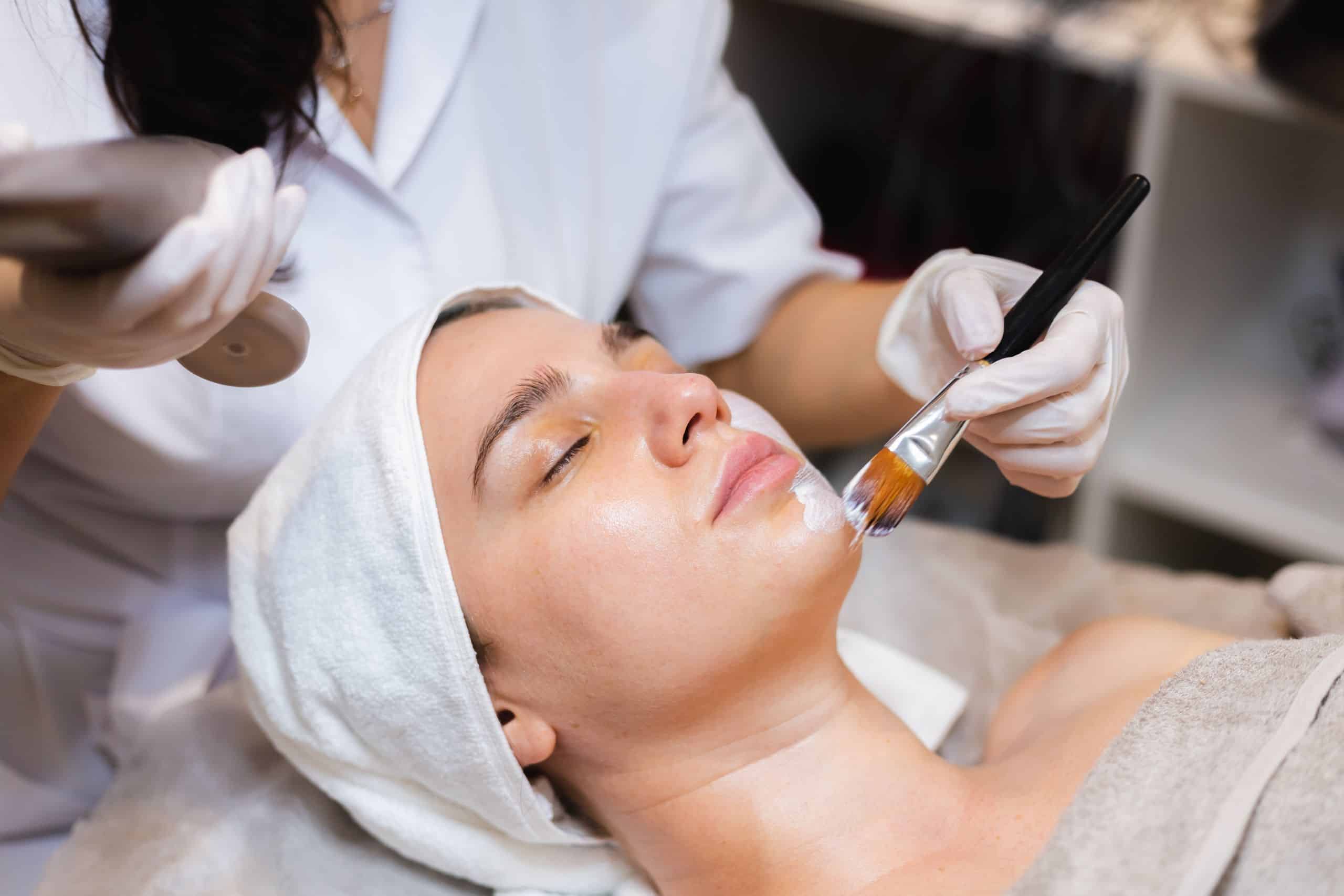 Melasma treatment to reduce dark patches and improve skin tone by Dr. Vaishna Aesthetic Physician
